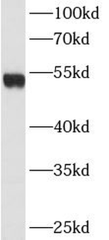 DES Mouse Monoclonal Antibody