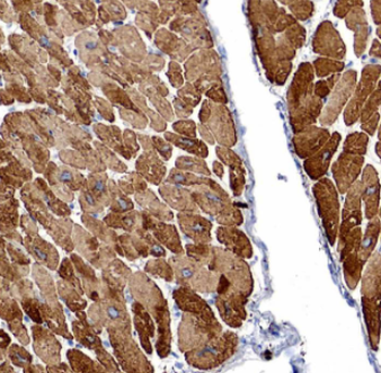 DES Mouse Monoclonal Antibody