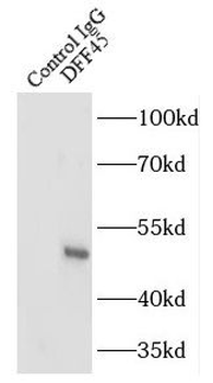 DFFA Antibody