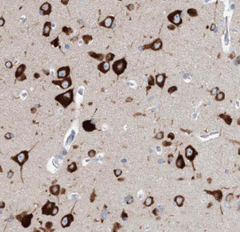 GSDME Antibody