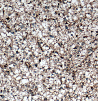 DGKA Antibody
