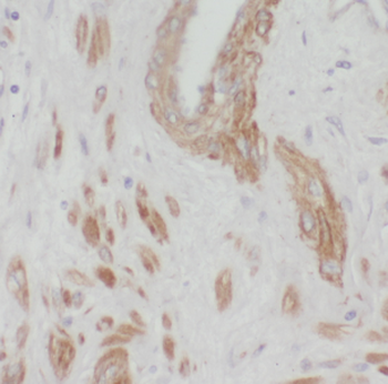 DGKE Antibody