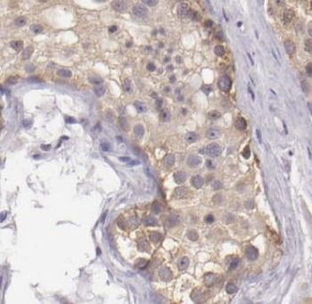 DGKH Antibody