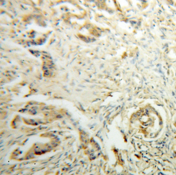 DHDH Antibody