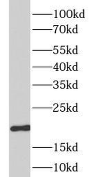 DHFR Antibody