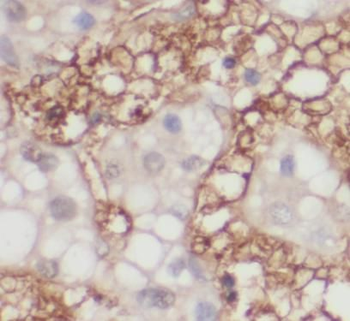 DHFR Antibody