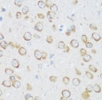 DHODH Antibody