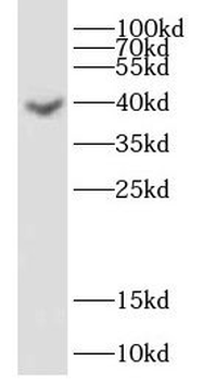 DHPS Antibody