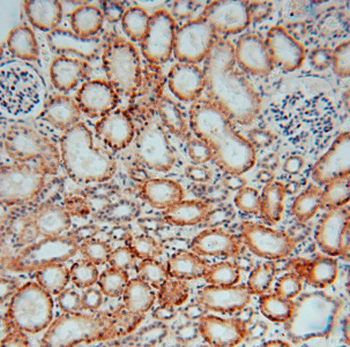 DHRS1 Antibody