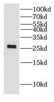 DHRS11 Antibody