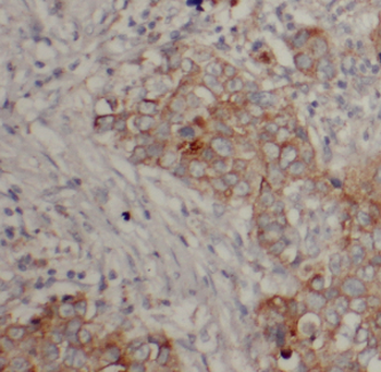 DHRS11 Antibody