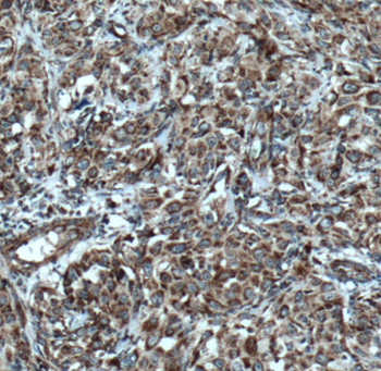 DHRS4 Antibody