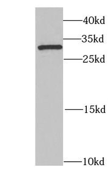 DHRS9 Antibody