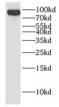DHX15 Rabbit Polyclonal Antibody