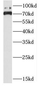DHX32 Antibody