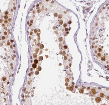 DHX32 Antibody