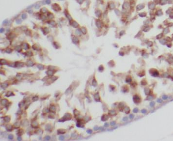 DIABLO Antibody