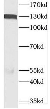 DIAPH3 Antibody