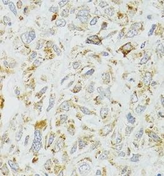 DICER1 Antibody