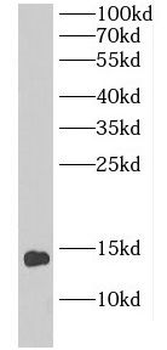 DIO1 Rabbit Polyclonal Antibody