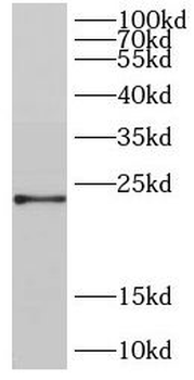 DIRAS2 Antibody