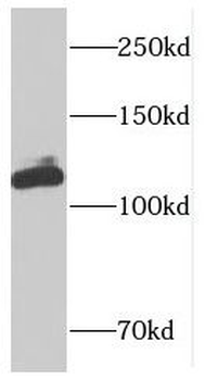DIS3L Antibody