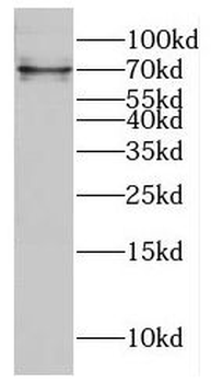 DIXDC1 Antibody