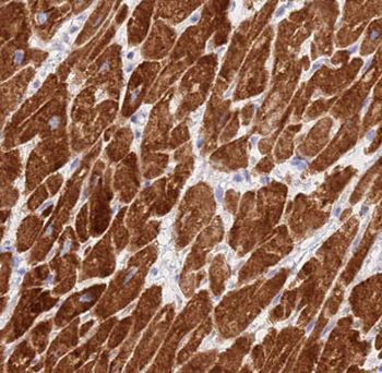 DIXDC1 Antibody