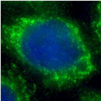 DKK1 Antibody