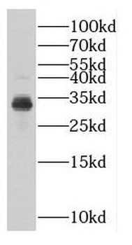 DKK1 Antibody