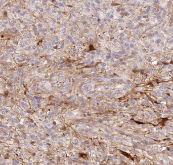 DKK1 Antibody