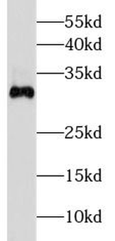 DKK2 Antibody