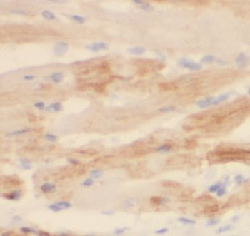 DKK2 Antibody