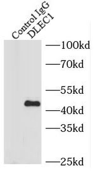 DLEC1 Antibody