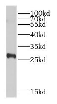 DLEU1 Rabbit Polyclonal Antibody
