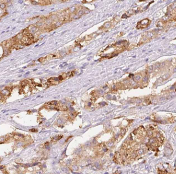 DLEU1 Rabbit Polyclonal Antibody