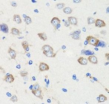 DLG1 Antibody