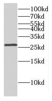DLX1 Antibody