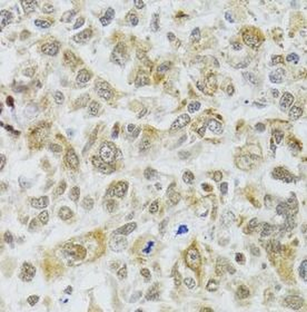 DMAP1 Antibody