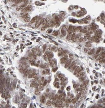 DMC1 Antibody