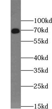 DMD Rabbit Polyclonal Antibody