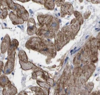 DMD Rabbit Polyclonal Antibody