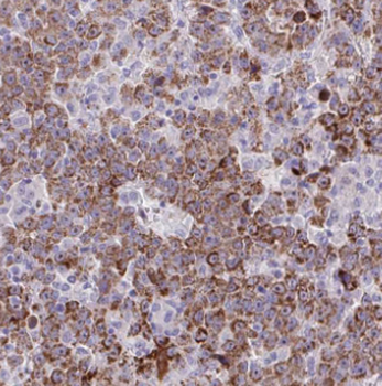 DMGDH Antibody