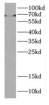 DMRTA1 Antibody