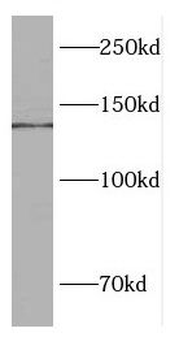 LIG1 Antibody