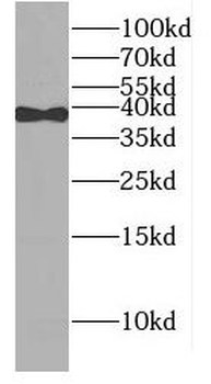 POLB Antibody