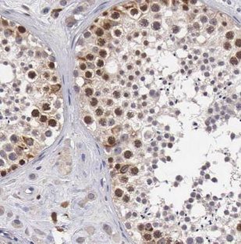 POLB Antibody