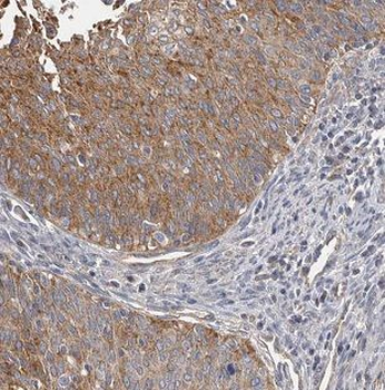DNA2 Antibody