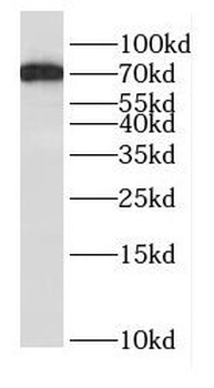 DNAI2 Rabbit Polyclonal Antibody