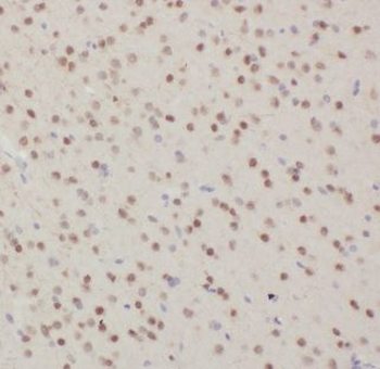DNAI2 Rabbit Polyclonal Antibody